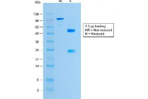 SDS-PAGE Analysis Purified Histone H1 Rabbit Recombinant Monoclonal Antibody (HH1/1784R).