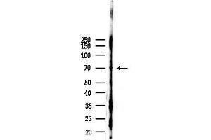 anti-PML-RARA Regulated Adaptor Molecule 1 (PRAM1) antibody