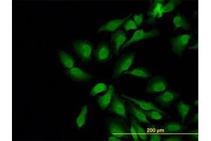 Image no. 1 for anti-Neural Wiskott-Aldrich syndrome protein (WASL) (AA 97-185) antibody (ABIN598590) (Neural Wiskott-Aldrich syndrome protein (WASL) (AA 97-185) anticorps)