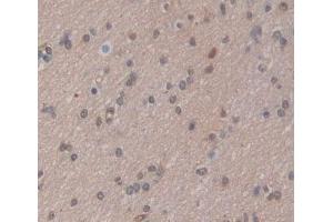 Used in DAB staining on fromalin fixed paraffin- embedded brain tissue