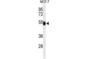 Western Blotting (WB) image for anti-Keratin 1 (KRT1) antibody (ABIN3004280)