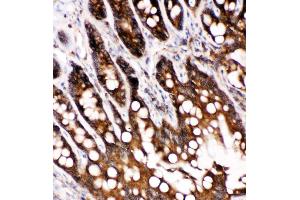 Anti-Caspase-6(P18) antibody,  IHC(P) IHC(P): Rat Intestine Tissue (Caspase 6 anticorps  (N-Term))