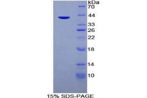 SDS-PAGE analysis of Human Mucin 6 Protein. (MUC6 Protéine)