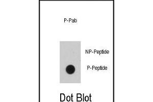 Dot blot analysis of anti-EGFR B1 Phospho-specific Pab (ABIN389891 and ABIN2839735) on nitrocellulose membrane. (EGFR anticorps  (pTyr1016))