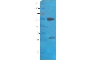 Western Blot using anti-polysialic acid antibody   Rat brain lysate was resolved on a 10% SDS PAGE gel and blots probed with  at 2 µg/ml before being detected by a secondary antibody. (Recombinant Polysialic Acid anticorps)