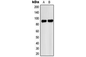 Western blot analysis of PNPLA8 expression in A549 (A), HeLa (B) whole cell lysates. (PNPLA8 anticorps  (C-Term))