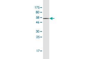 Western Blot detection against Immunogen (49. (CLTA anticorps  (AA 1-218))