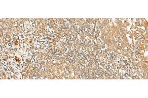 Immunohistochemistry of paraffin-embedded Human tonsil tissue using PROKR1 Polyclonal Antibody at dilution of 1:40(x200) (Prokineticin Receptor 1 anticorps)