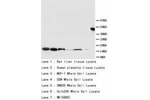 Image no. 2 for anti-Superoxide Dismutase (AA 113-129) antibody (ABIN1493374)
