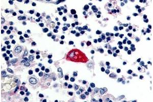 Human Macrophage (formalin-fixed, paraffin-embedded) stained with EMR3 antibody ABIN213514 at 2.