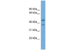 PRPSAP2 antibody used at 0. (PRPSAP2 anticorps  (Middle Region))