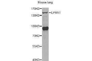 Western blot analysis of extracts of mouse lung, using EPHA1 antibody (ABIN6290349) at 1:1000 dilution. (EPHA1 anticorps)