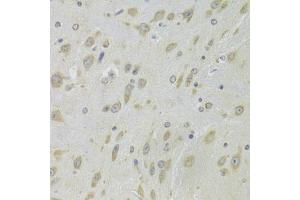 Immunohistochemistry of paraffin-embedded mouse brain using DHRS9 Antibody (ABIN5973740) at dilution of 1/100 (40x lens). (DHRS9 anticorps)