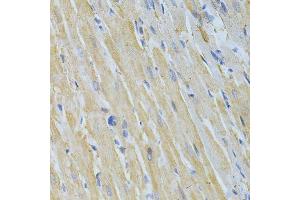 Immunohistochemistry of paraffin-embedded rat heart using NME1 Antibody. (NME1 anticorps  (C-Term))