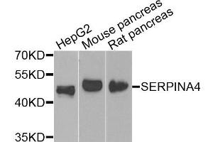 Western blot analysis of extracts of various cells, using SERPINA4 antibody. (SERPINA4 anticorps)