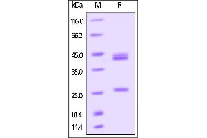 Biotinylated Human IL-23 alpha & IL-12 beta Heterodimer on SDS-PAGE under reducing (R) condition. (IL12A & IL27B (AA 20-189) (Active) protein (His tag,AVI tag,Biotin))