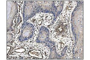 IHC analysis of TAGLN/Transgelin using anti-TAGLN/Transgelin antibody (ABIN7600099).