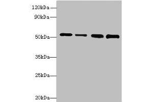 Western blot All lanes: STK38L antibody at 6 μg/mL Lane 1: A375 whole cell lysate Lane 2: HepG2 whole cell lysate Lane 3: A549 whole cell lysate Lane 4: HCT116 whole cell lysate Secondary Goat polyclonal to rabbit IgG at 1/10000 dilution Predicted band size: 55, 44 kDa Observed band size: 55 kDa (STK38L anticorps  (AA 212-464))