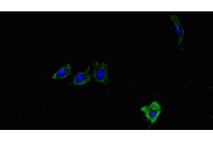 Immunofluorescent analysis of Hela cells using ABIN7176901 at dilution of 1:100 and Alexa Fluor 488-congugated AffiniPure Goat Anti-Rabbit IgG(H+L)