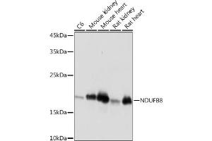 Western blot analysis of extracts of various cell lines, using NDUFB8 Rabbit mAb (ABIN7268813) at 1:1000 dilution.
