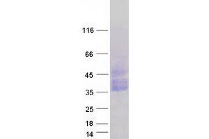 Validation with Western Blot