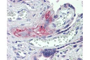 Anti-F2 / Thrombin antibody IHC staining of human placenta.