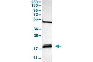 Western Blot analysis of human cell line RT-4 with PTRH2 polyclonal antibody . (PTRH2 anticorps  (AA 42-178))