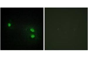 Immunofluorescence analysis of HeLa cells, using Histone H2B Antibody.