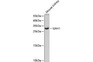 Western blot analysis of extracts of mouse kidney, using SI antibody (ABIN3016131, ABIN3016132, ABIN3016133 and ABIN6219568) at 1:1000 dilution.