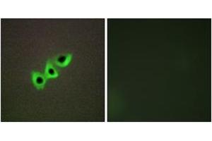 Immunofluorescence analysis of A549 cells, using RHG07 Antibody. (DLC1 anticorps  (AA 61-110))