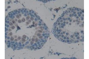 IHC-P analysis of Rat Testis Tissue, with DAB staining. (CPB2 anticorps  (AA 164-417))