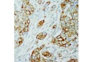 anti-V-Akt Murine Thymoma Viral Oncogene Homolog 1/2 (AKT1/2) (N-Term) antibody