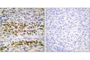 Immunohistochemistry analysis of paraffin-embedded human ovary tissue, using NF-kappaB p105/p50 (Ab-923) Antibody. (NFKB1 anticorps  (AA 891-940))