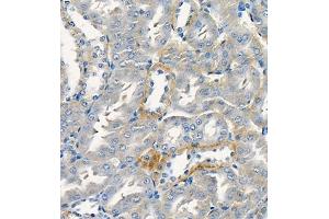 Immunohistochemistry of paraffin embedded rat kidney using Cdcp1 (ABIN7073600) at dilution of 1:300 (400x lens) (CDCP1 anticorps)