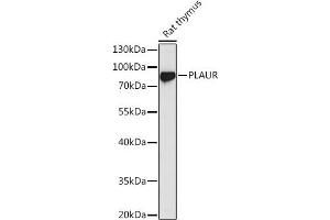 Western blot analysis of extracts of Rat thymus, using PLAUR antibody (ABIN3015469, ABIN3015470, ABIN5663892 and ABIN6218162) at 1:1000 dilution. (PLAUR anticorps  (AA 23-305))