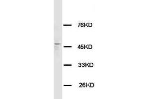 Anti-HRH3 antibody, Western blotting WB: Rat Brain Tissue Lysate (HRH3 anticorps  (C-Term))