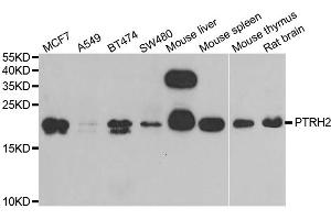 Western blot analysis of extracts of various cell lines, using PTRH2 antibody (ABIN5973864) at 1/1000 dilution. (PTRH2 anticorps)