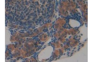 Detection of CNX in Mouse Ovary Tissue using Polyclonal Antibody to Calnexin (CNX)