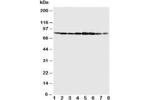 Western blot testing of MCM7 antibody and Lane 1:  COLO320;  2: SW620;  3: HeLa;  4: 22RVL;  5: 293T;  6: U937;  7: Jurkat;  8: Raji cell lysate. (MCM7 anticorps  (C-Term))