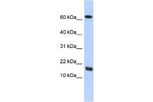 WB Suggested Anti-C4orf46 Antibody Titration: 0. (C4orf46 anticorps  (Middle Region))