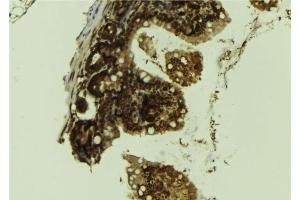 ABIN6276559 at 1/100 staining Mouse colon tissue by IHC-P.
