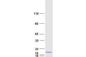 Validation with Western Blot (UBE2D2 Protein (Transcript Variant 1) (Myc-DYKDDDDK Tag))