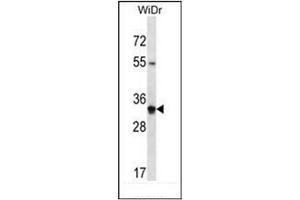 Western blot analysis of OR2W5 Antibody (C-term) in WiDr cell line lysates (35ug/lane). (OR2W5 anticorps  (C-Term))