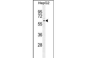 ARD Antibody (C-term) (ABIN655880 and ABIN2845281) western blot analysis in HepG2 cell line lysates (35 μg/lane). (PPARD anticorps  (C-Term))