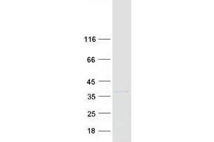 Validation with Western Blot