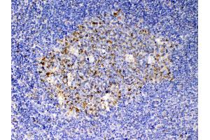 IHC analysis of SCF using anti-SCF antibody .