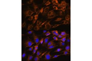 Immunofluorescence analysis of C6 cells using  Rabbit pAb (ABIN6133587, ABIN6137053, ABIN6137054 and ABIN6224632) at dilution of 1:100.