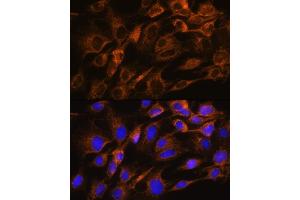Immunofluorescence analysis of C6 cells using  Rabbit pAb (ABIN6133587, ABIN6137053, ABIN6137054 and ABIN6224632) at dilution of 1:100. (Aquaporin 8 anticorps  (AA 50-150))