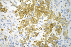 anti-Neural Precursor Cell Expressed, Developmentally Down-Regulated 9 (NEDD9) antibody