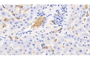Detection of HBb in Bovine Liver Tissue using Polyclonal Antibody to Hemoglobin Beta (HBb)